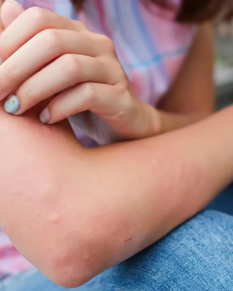 #ÉtéSansSouci #lesbonsgestes🦟 📢 Chacun à son niveau peut contribuer à limiter le risque de prolifération et d’installa… 